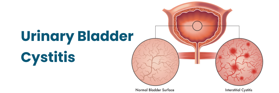 Urinary Bladder Cystitis