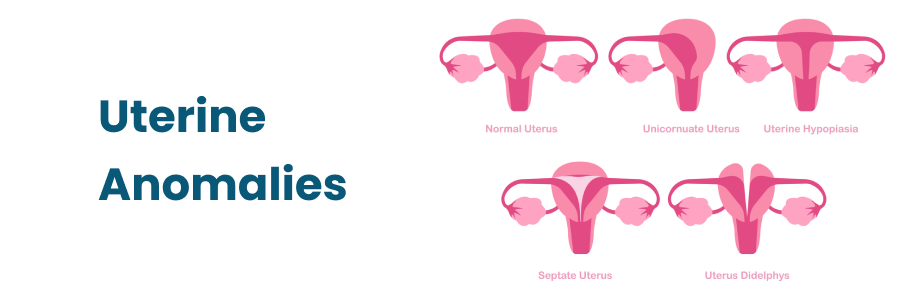 Uterine Anomalies