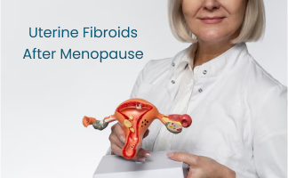 Uterine Fibroids After Menopause: Identifying Symptoms