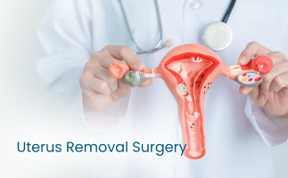 Uterus Removal Surgery Types Side Effects  Recovery