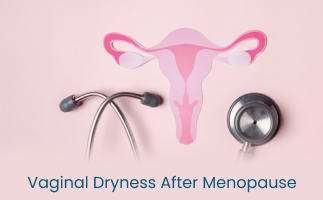 Vaginal Dryness After Menopause Causes and Relief Options