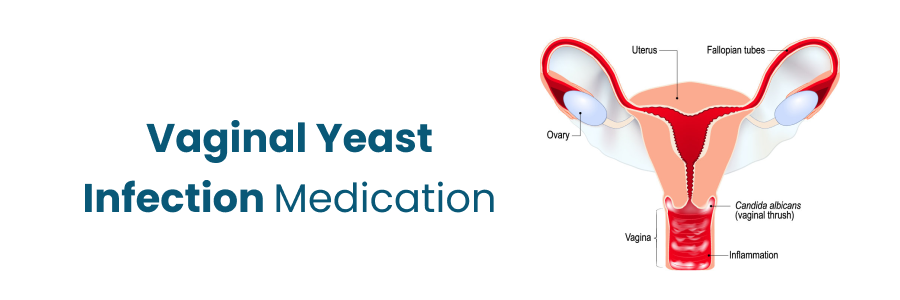 Vaginal Yeast Infection Medication