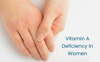 How to Manage the Symptoms of Vitamin A Deficiency in Women