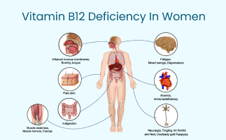 Vitamin B12 Deficiency in Women Symptoms and Diagnosis