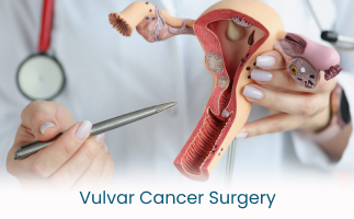 Surgery for Ovarian Cancer What It Involves and What to Expect