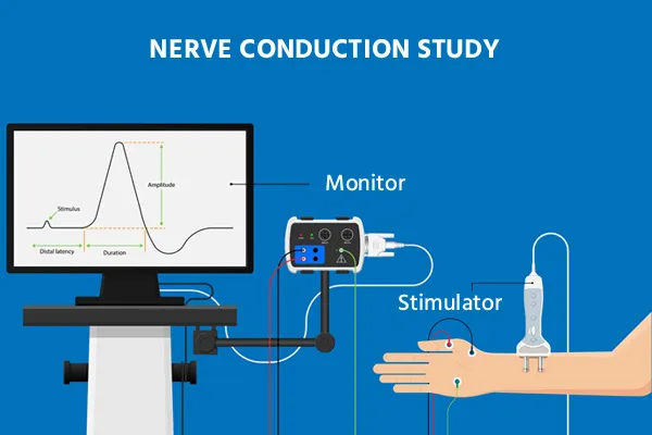 EMG/NCV Test