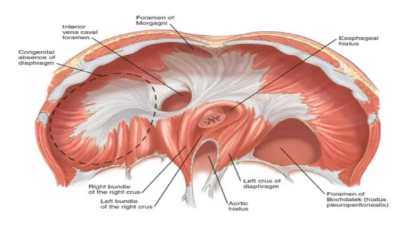 diaphragmatic-hernia-7