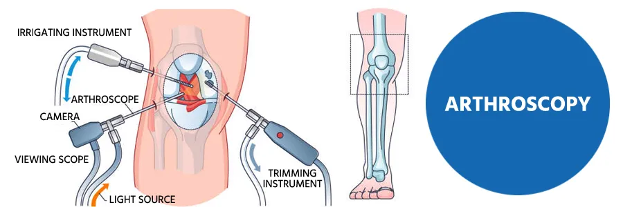 benefits of abdominoplasty