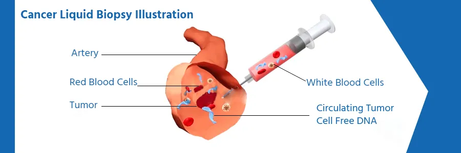 Needle biopsy