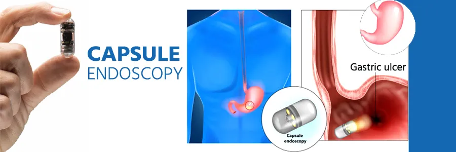 capsule-endoscopy-cost