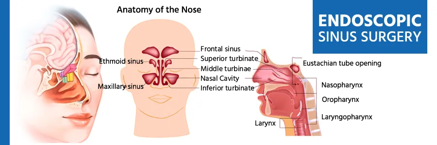 Functional Endoscopic Sinus