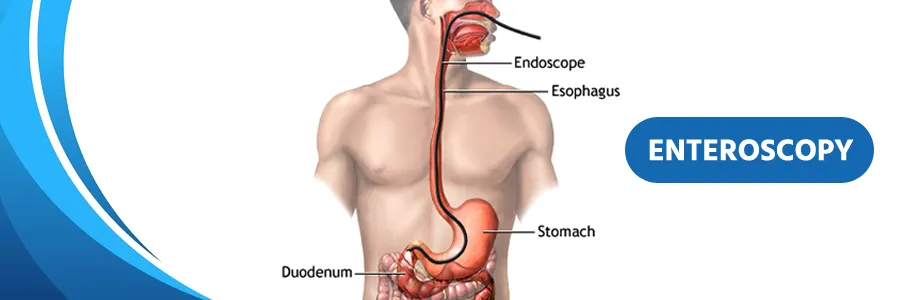 Enteroscopy