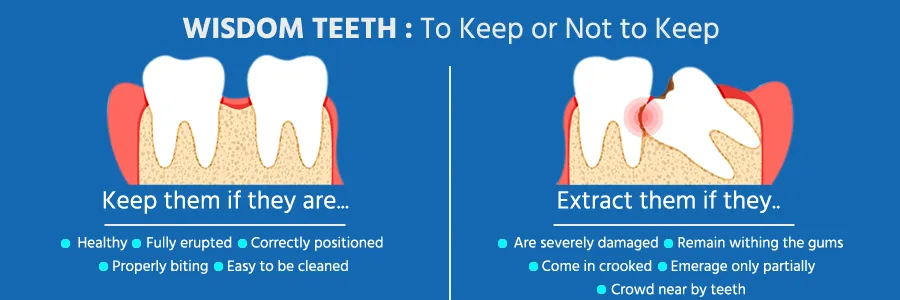 Extraction of Wisdom Teeth