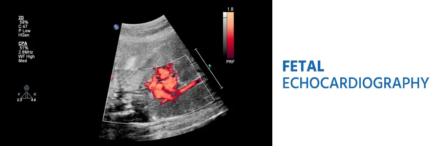 Fetal Echocardiography