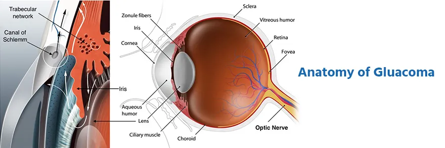 Glaucoma Surgery