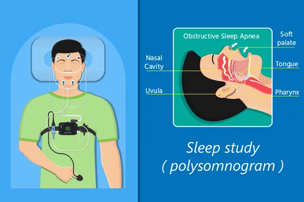 sleep-study-cost