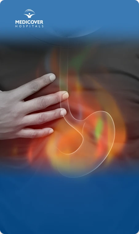 Acid reflux symptoms