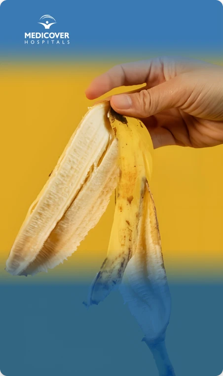 Banana Peel