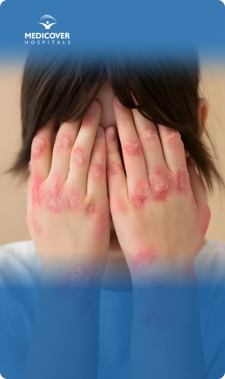 dealing itchy red skin issues