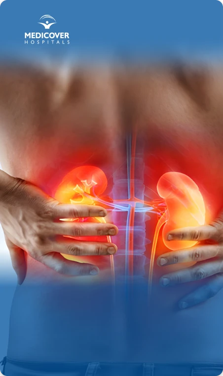 Kidney Stone Pain