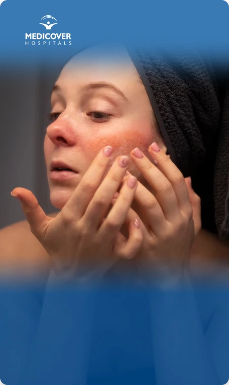 Protect Your Skin from Winter Dryness