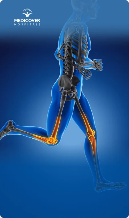 Tips for Managing Osteoporosis