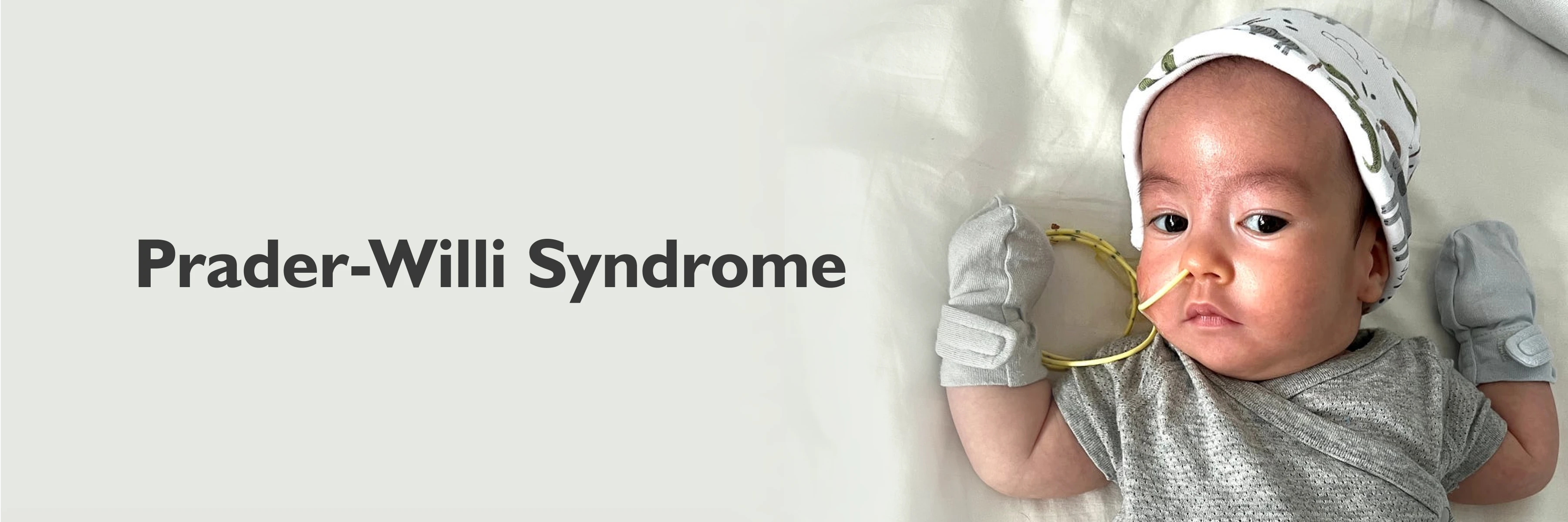 Prader-Willi Syndrome