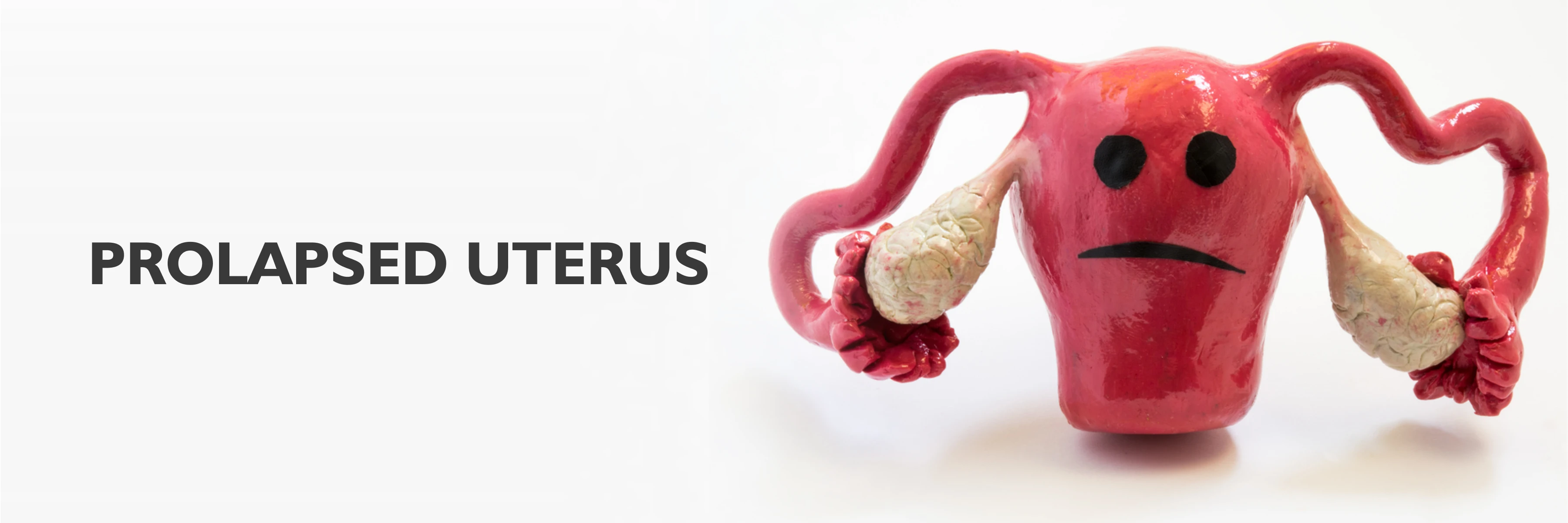 Prolapsed Uterus