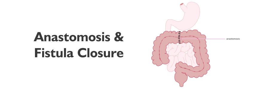 Anastomosis and Fistula Closure