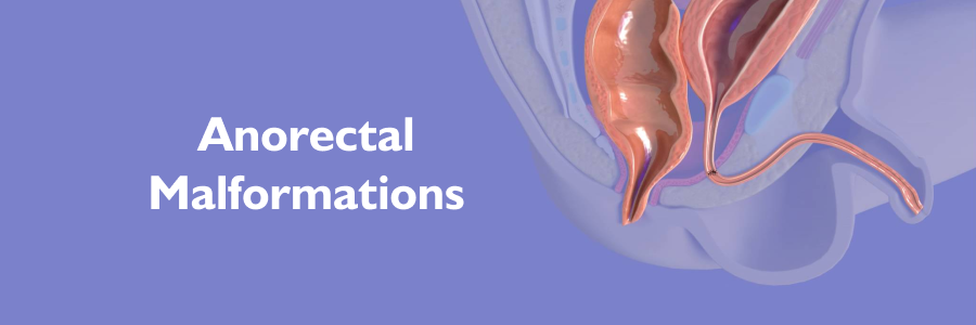 Anorectal Malformations