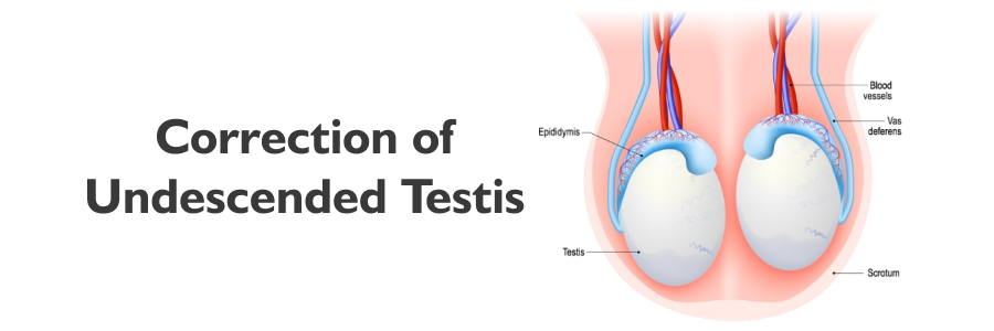 Correction of Undescended Testis