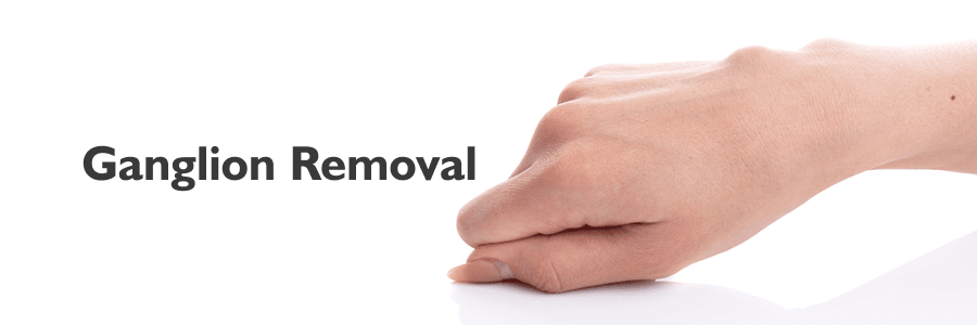 Ganglion Removal