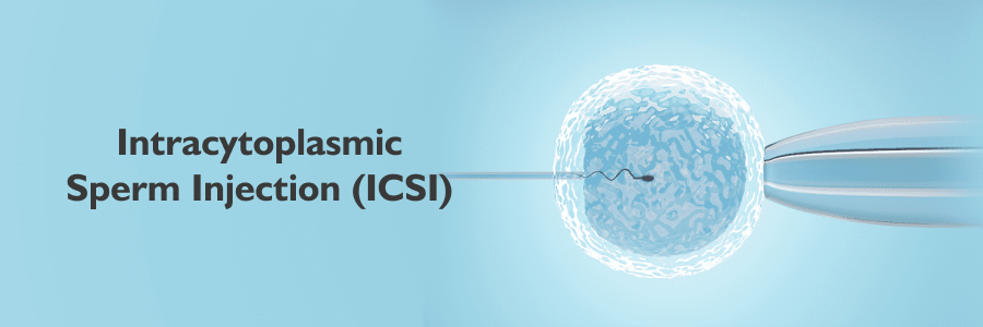 Intracytoplasmic Sperm Injection (ICSI)