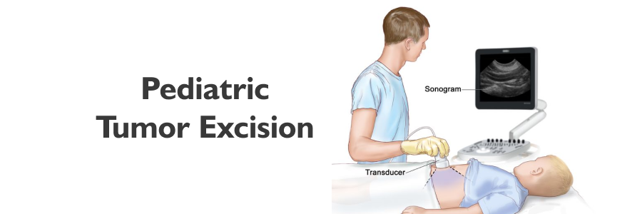 Pediatric Tumor Excision