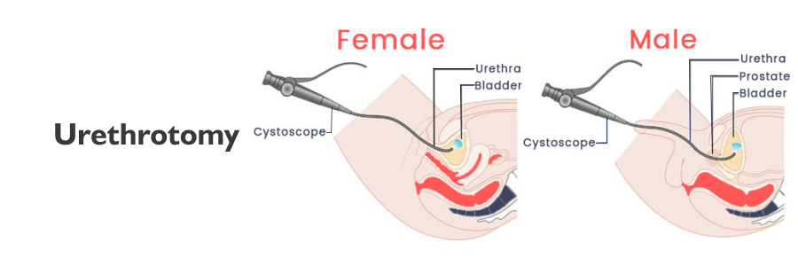 Urethrotomy