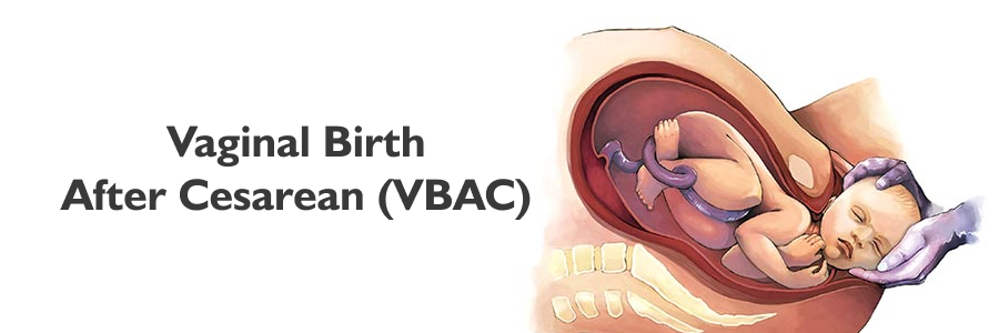 Vaginal Birth After Cesarean (VBAC)